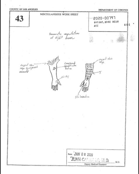 kobe and gigi autoposy|Kobe Bryant Autopsy Report: His Cause of Death。